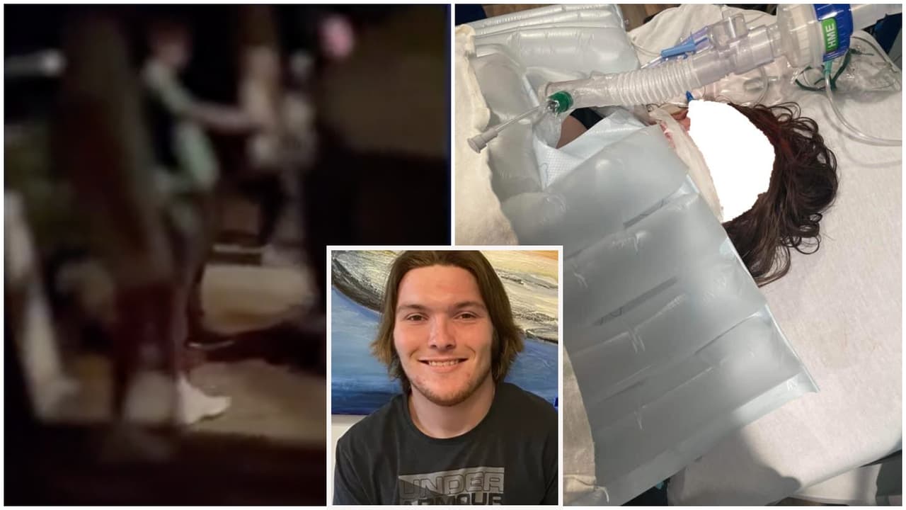 “Pensó que eran sus amigos”: adolescente de 19 años termina hospitalizado tras una novatada en una fiesta