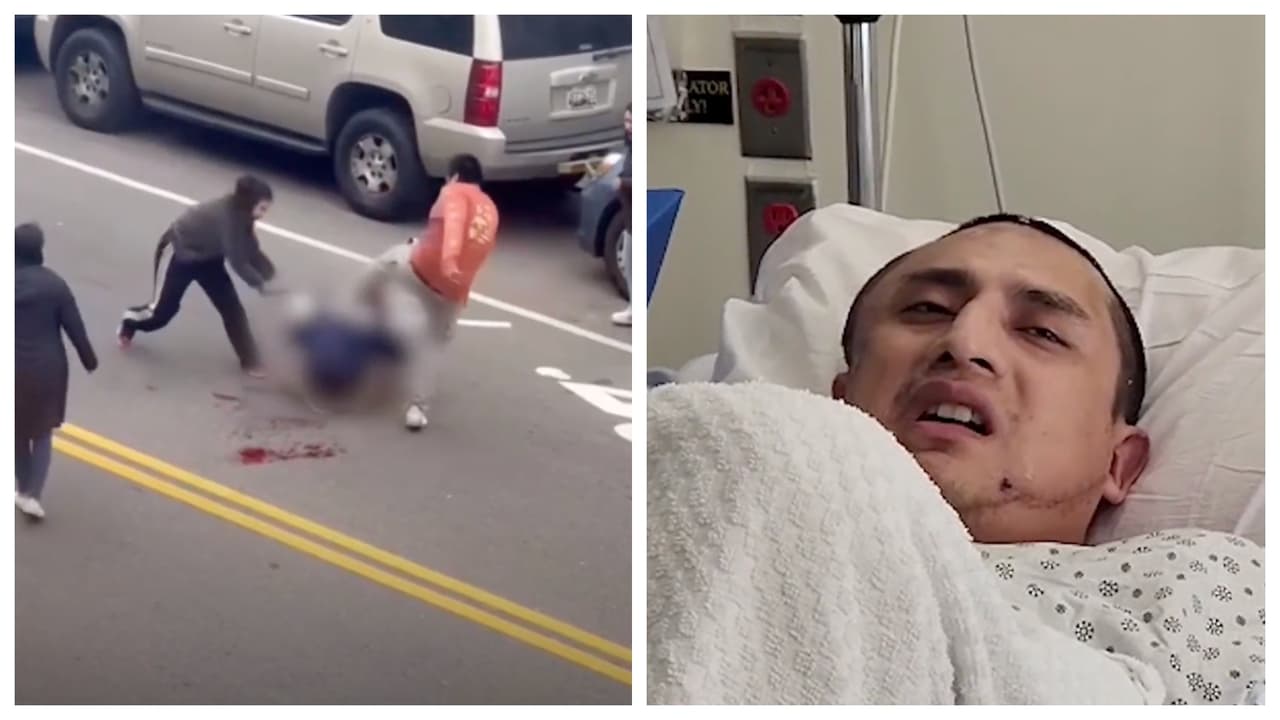 Sale del coma Wilson Chablá, atacado con bate en una disputa por un estacionamiento