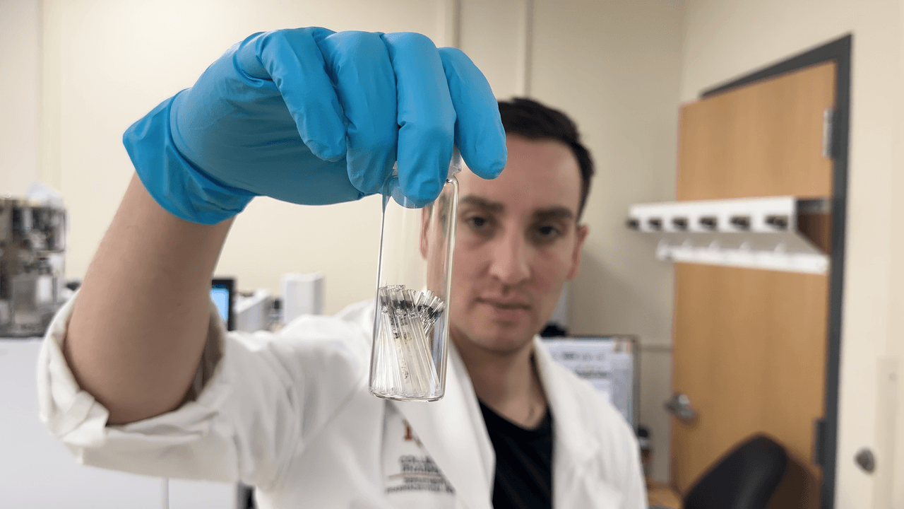 El preocupante hallazgo de numerosos microplásticos en el cerebro humano