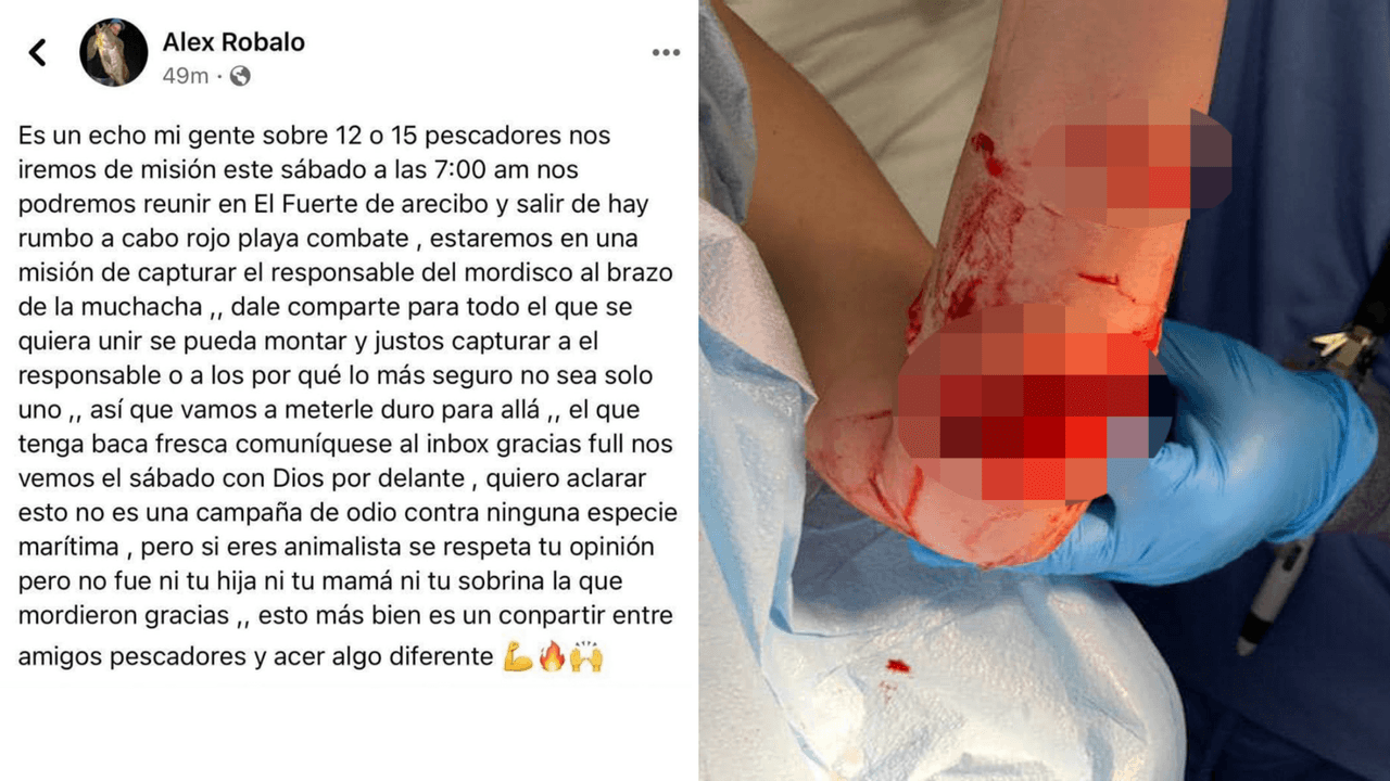 Pescadores salen a cazar picúas tras mordida a una joven en el brazo