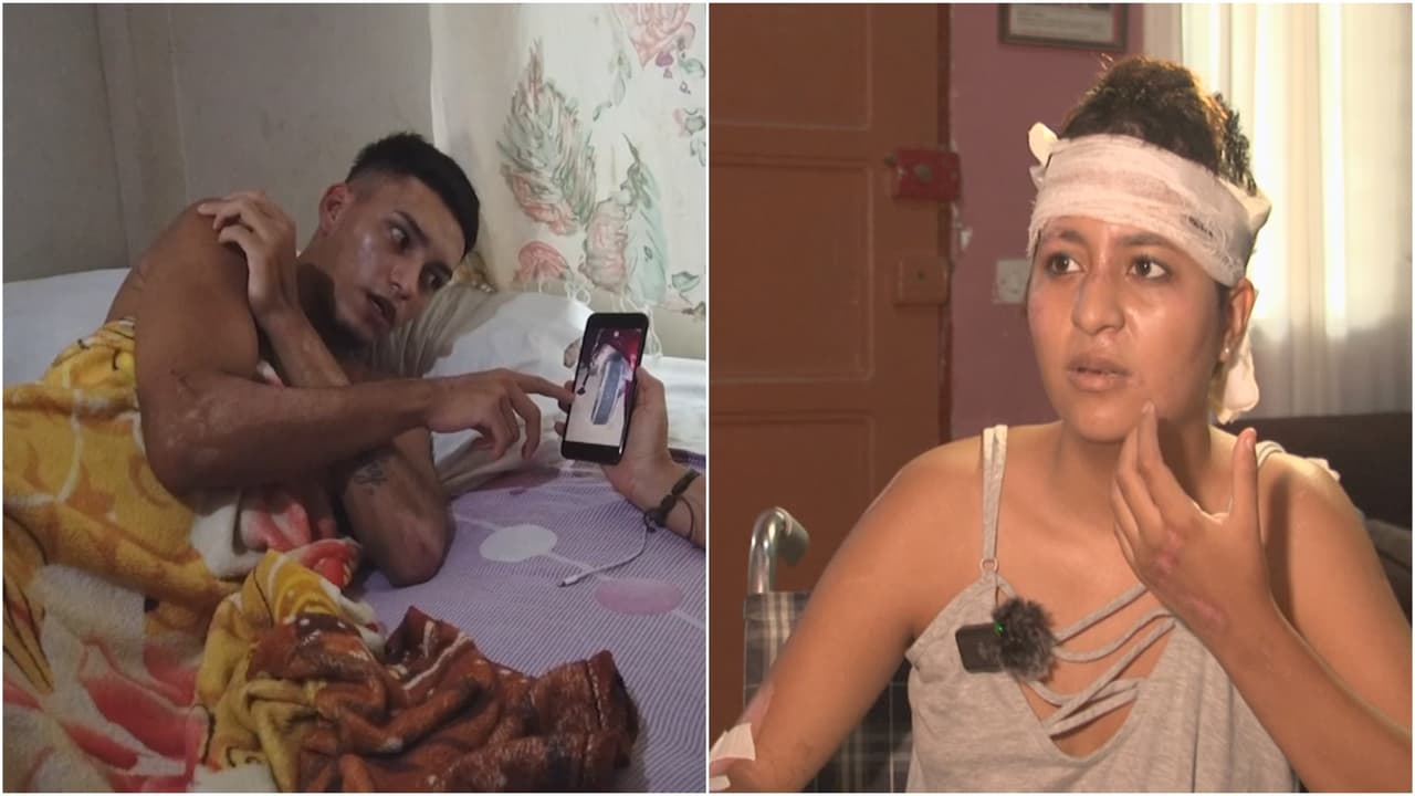 Ayuda de Impacto: Su expareja la pasó por encima a ella y a un amigo tres veces con un carro. Ahora intenta rehacer su vida