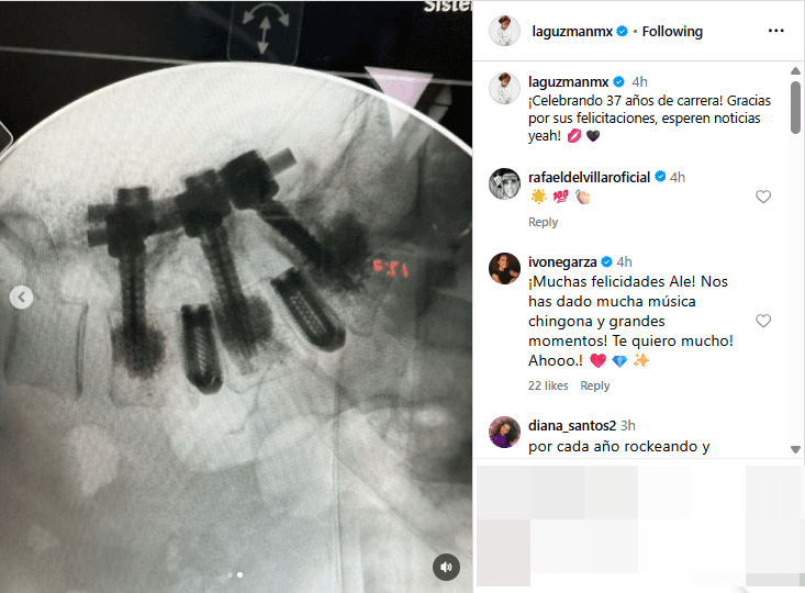 Alejandra Guzmán compartió detalles de su estado de salud tras someterse a cirugía de columna.