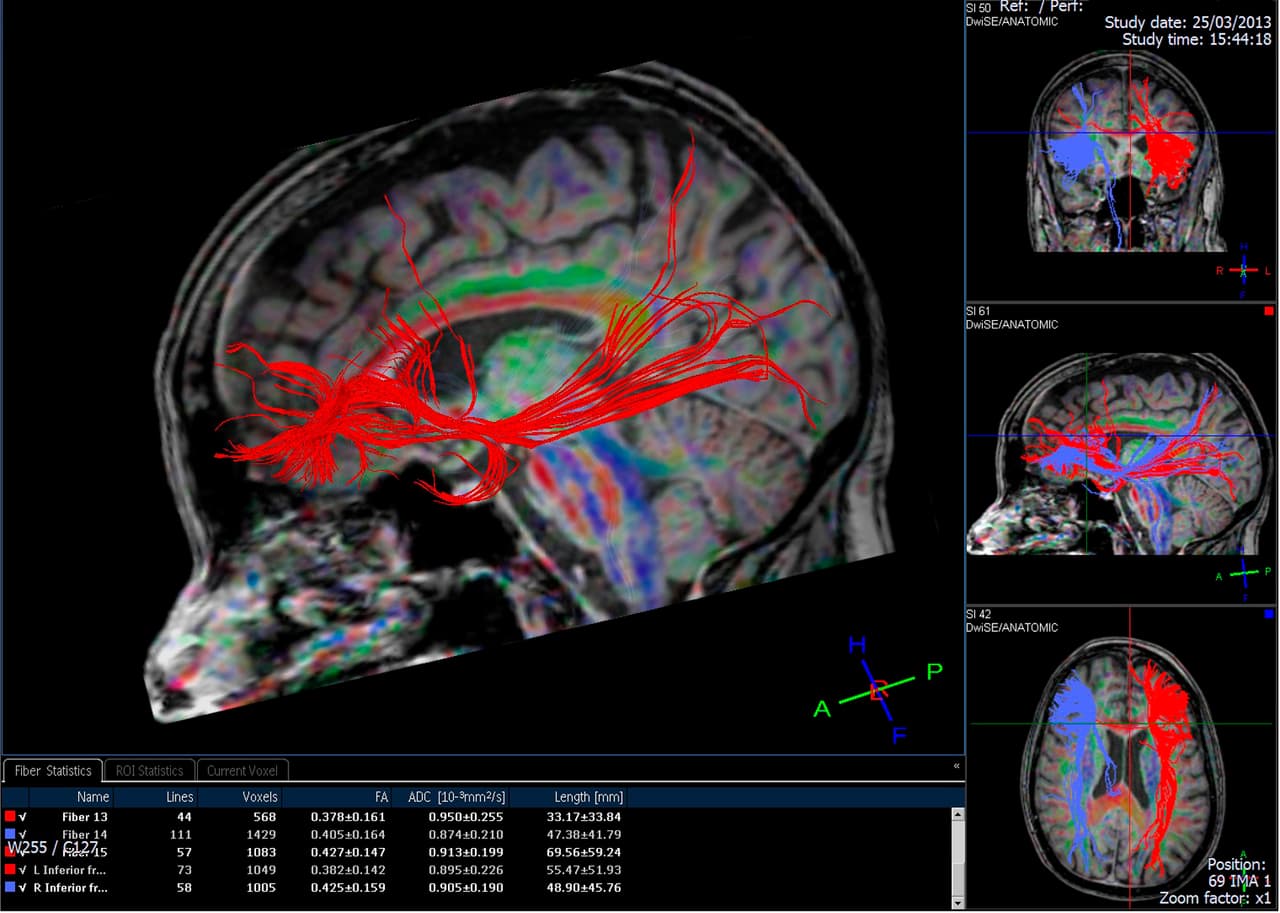 Esta es la desconcertante zona del cerebro que conecta, literalmente, el cuerpo y la mente