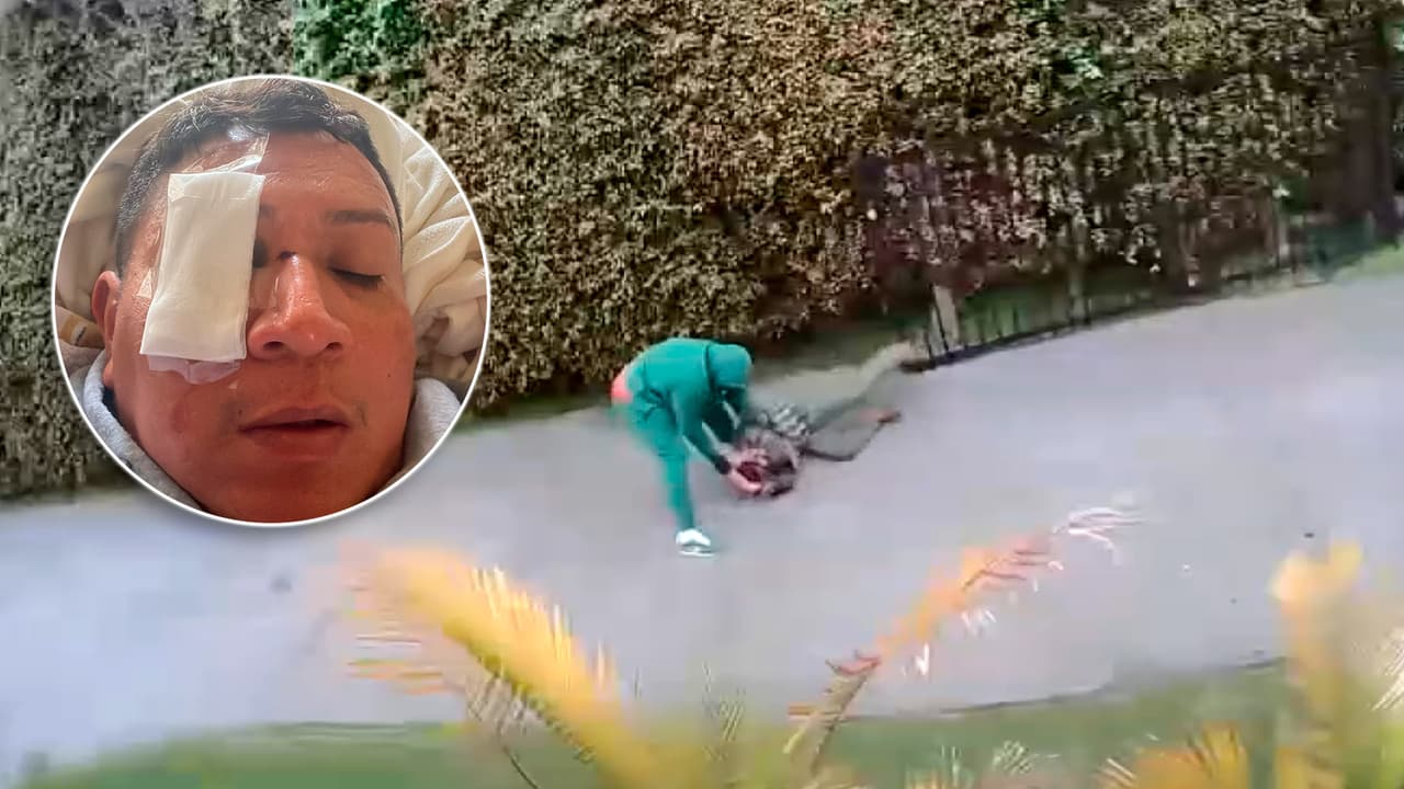 “Te odio, mexicano": Hombre latino recibe brutal golpiza en posible crimen de odio en Inglewood