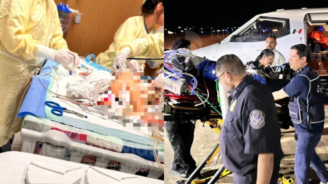 Revelan estado de salud de Jazlyn, la niña que sufrió heridas tras explosión de una pipa de gas en Iztapalapa