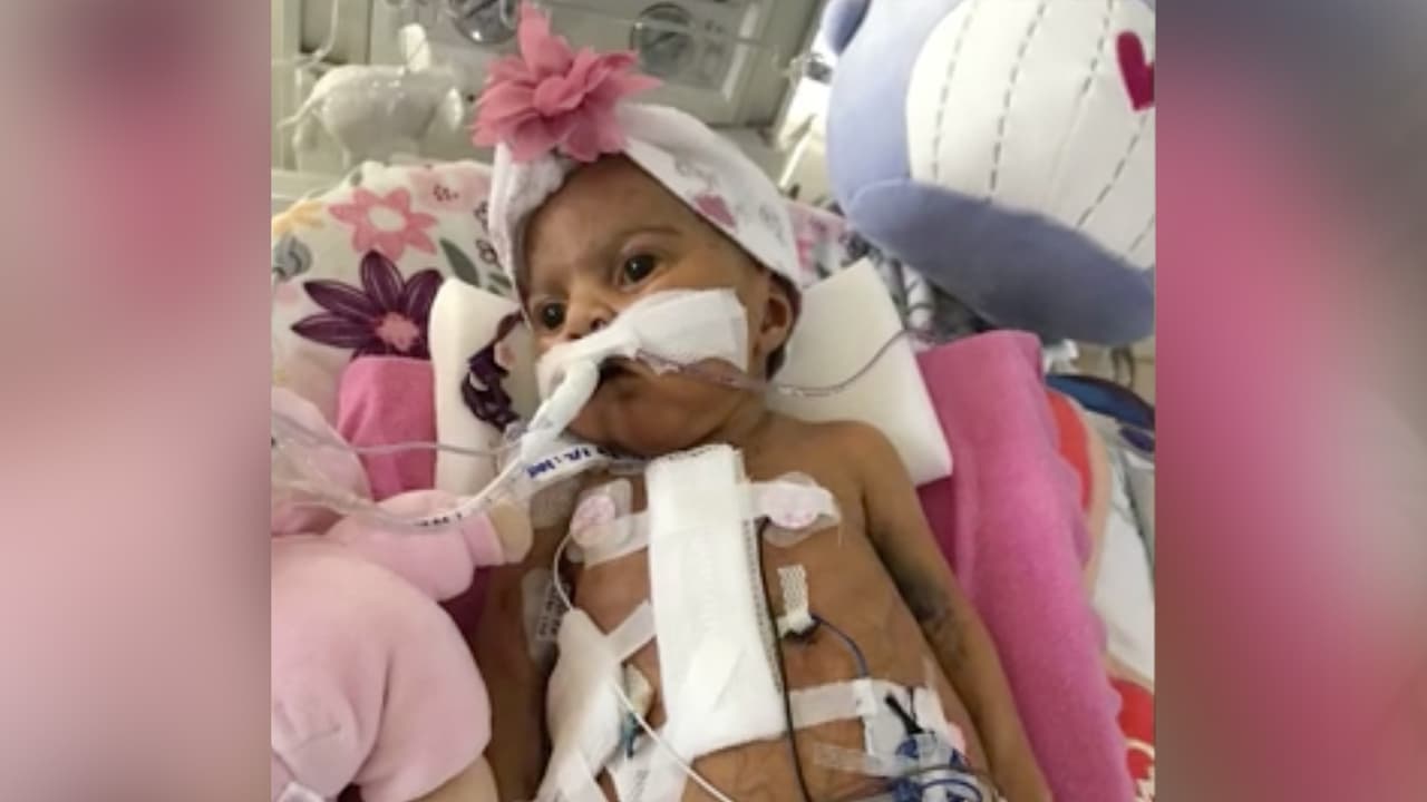 “Debido a eso mi hija tuvo un problema en el cerebro, a mi hija sus riñones no le funcionan, a mi hija ahorita la operaron del intestino grueso”, asegura entre lágrimas la madre hispana.