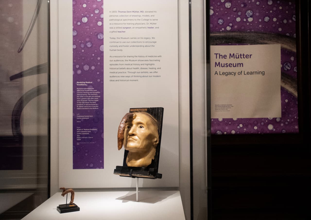 Visitantes son recibidos por una de las exhibiciones más famosas del Museo Mütter: el modelo en cera de Madame Dimanche.
<br>
<br>