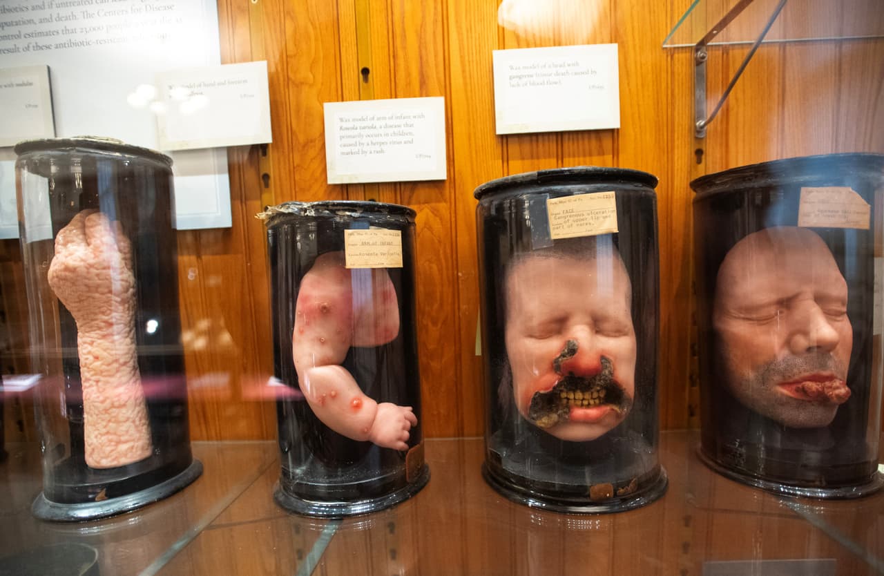 Gemelos siameses, fetos abortados y partes del cerebro de Albert Einstein forman parte de la colección del Mütter Museum de Filadelfia.
<br>
<br>Moldeado en cera de pacientes con diversas enfermedades cutáneas y faciales en la galería principal de la Biblioteca Médica Histórica del Museo Mütter, en Filadelfia, Pensilvania. El moldeado en cera de pacientes era un método popular con fines de estudio para estudiantes de medicina y otros médicos. Cuando esta práctica era una herramienta educativa popular para los estudiantes de medicina en Europa, Thomas Mütter trajo ejemplares de Francia en el siglo XIX, que aún se conservan en el museo.