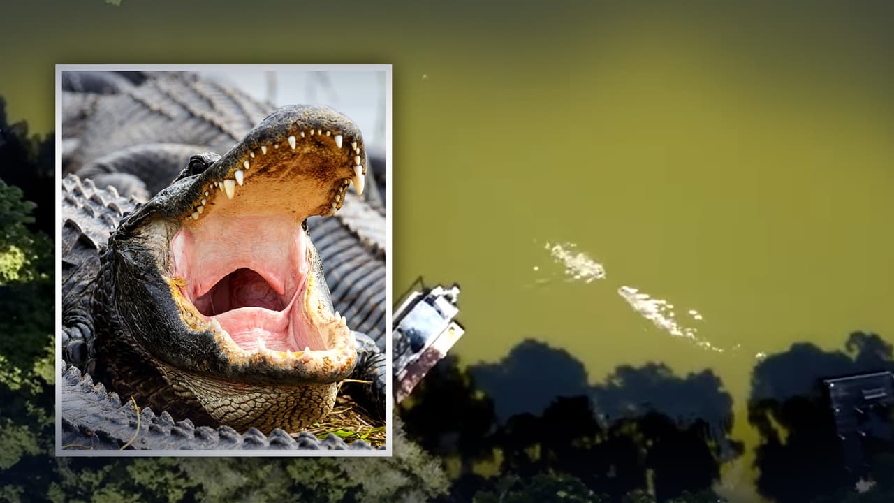 En video: Hispano sobrevive a mordida de caimán que le aplastó el cráneo