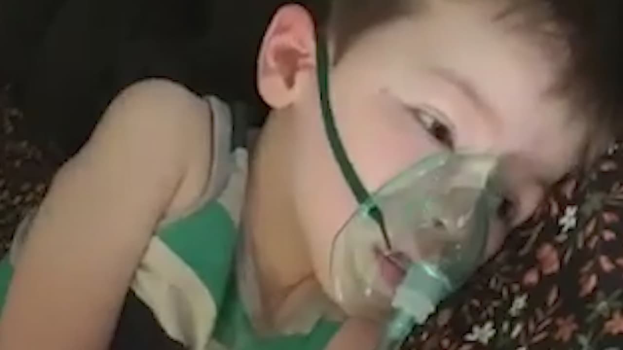 “Puede morir mientras convulsiona”: este niño mexicano niño sufre de un extraño síndrome