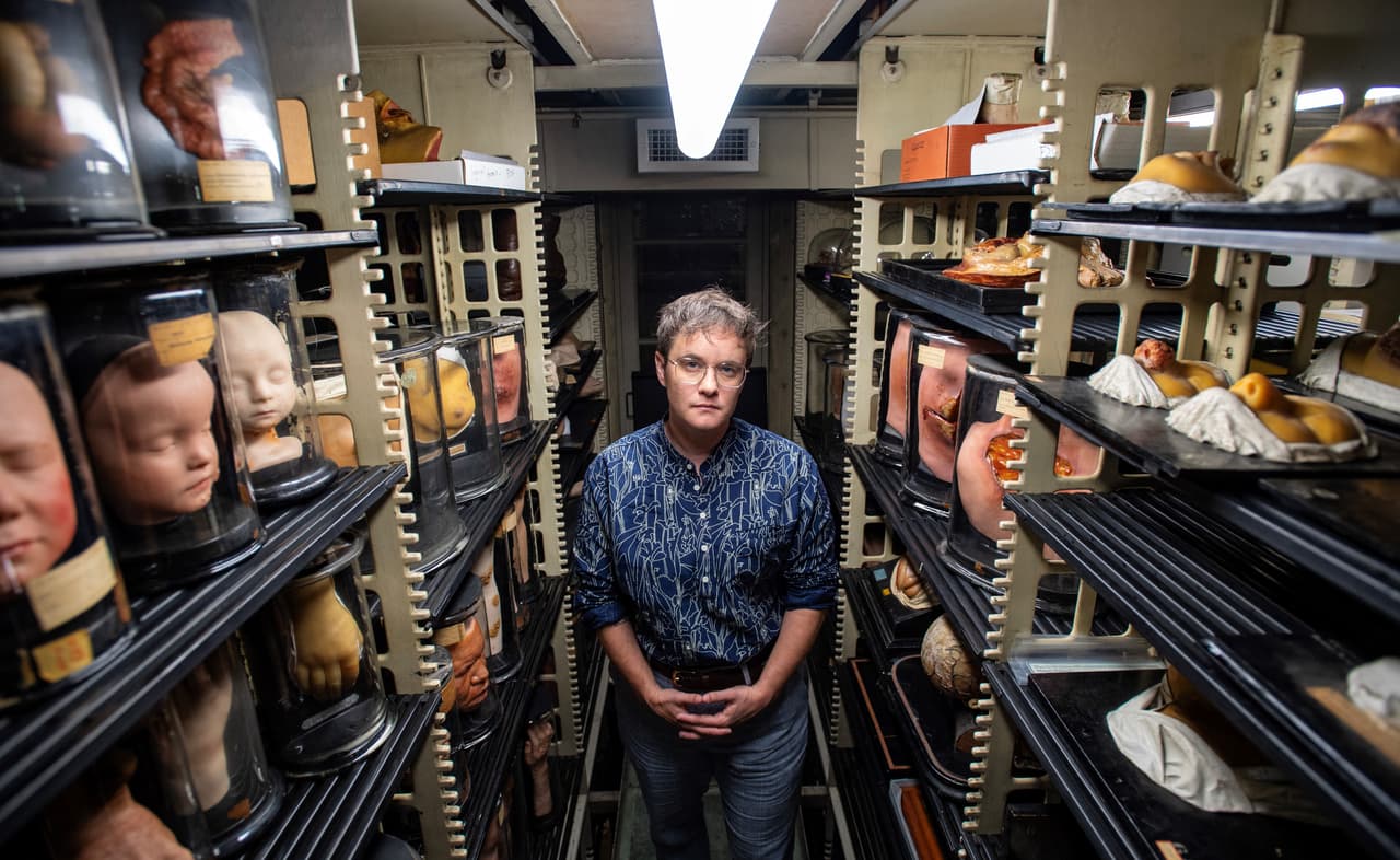 Sara Ray, directora senior de interpretación y participación en el Museo Mütter, asumió parte de las responsabilidades de Quinn.
<br>
<br>Un exdirector escribió en The Wall Street Journal que “un puñado de élites
<i>woke</i> cuestionan el pasado del museo y comprometen su futuro”.
<br>