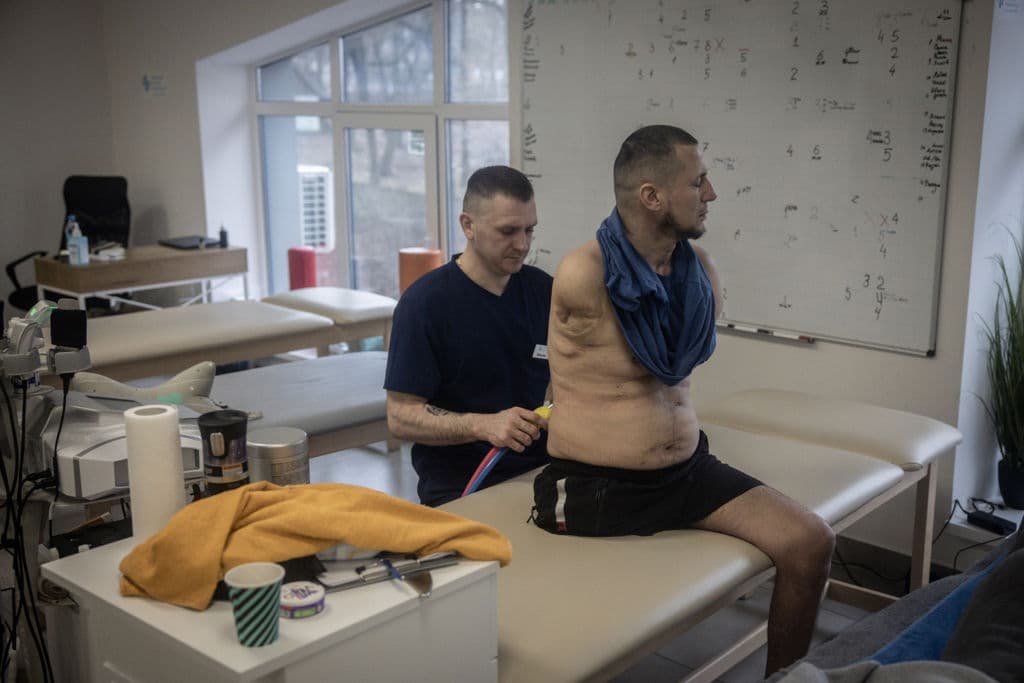 Oleksandr, un soldado de 43 años triplemente amputado, en una clínica de rehabilitación en Kiev, Ucrania. El 24 de febrero de 2024 se cumplieron dos años desde la invasión de Rusia a Ucrania, que ha dejado decenas de miles de muertos, aunque ninguno de los dos países publica cifras oficiales de bajas. La guerra también ha provocado inseguridad económica en el mundo, ha aislado a Rusia de Occidente y, aunque inicialmente unificó a los
<a href="https://www.univision.com/noticias/estados-unidos/atacms-moscu-advierte-a-eeuu-sobre-el-permiso-a-ucrania-para-usar-sus-misiles-sobre-rusia-esta-echando-lena-al-fuego">países de la OTAN,</a> ha expuesto tensiones entre los aliados occidentales sobre la escala y la duración del apoyo militar a Ucrania.