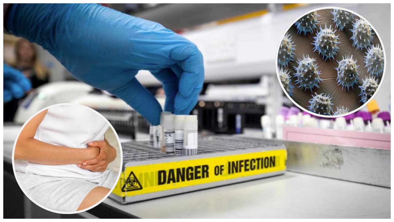 Florida es el segundo estado con más casos de brotes de norovirus en EEUU ¿cuáles son los síntomas?