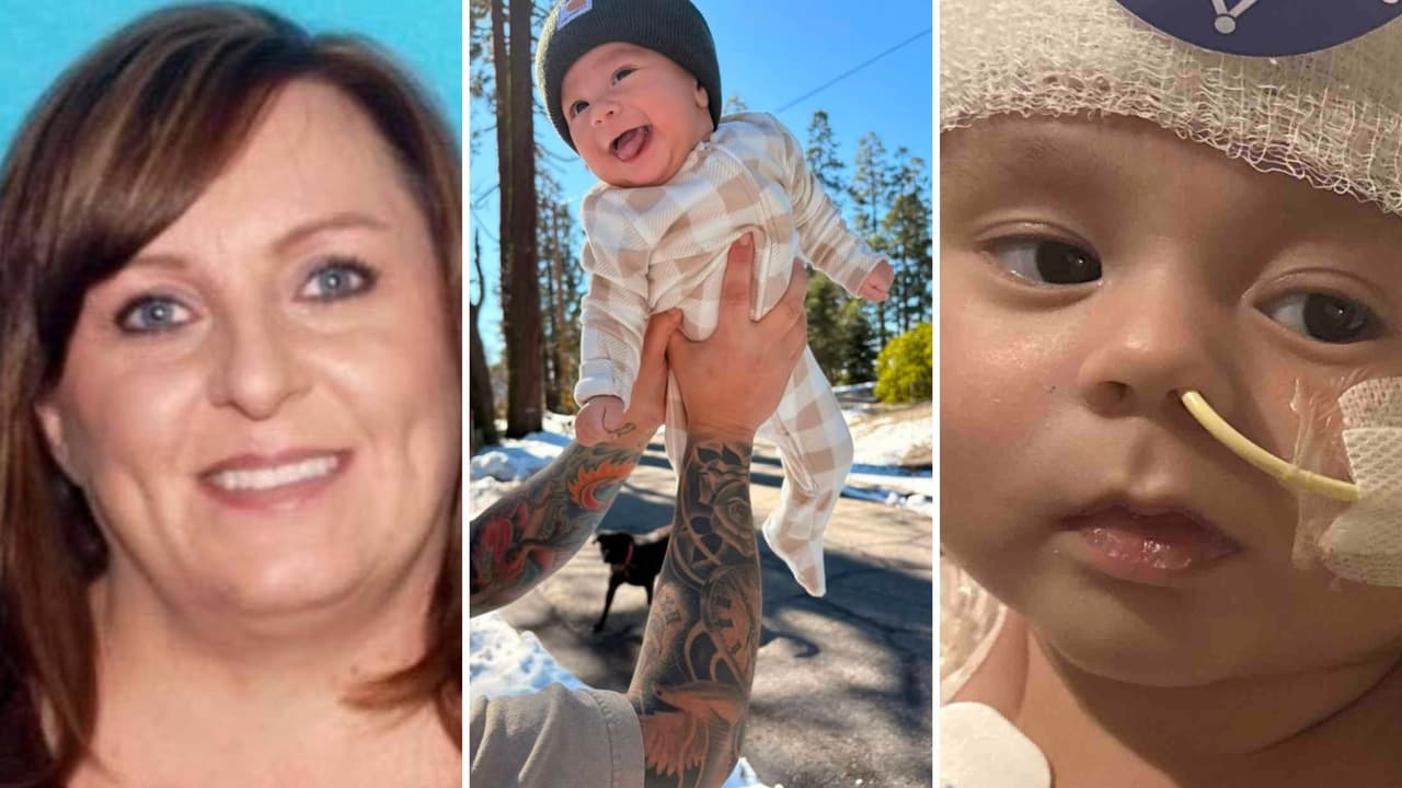 Bebé que perdió la mitad de su cráneo tras abusos de su niñera sale del hospital