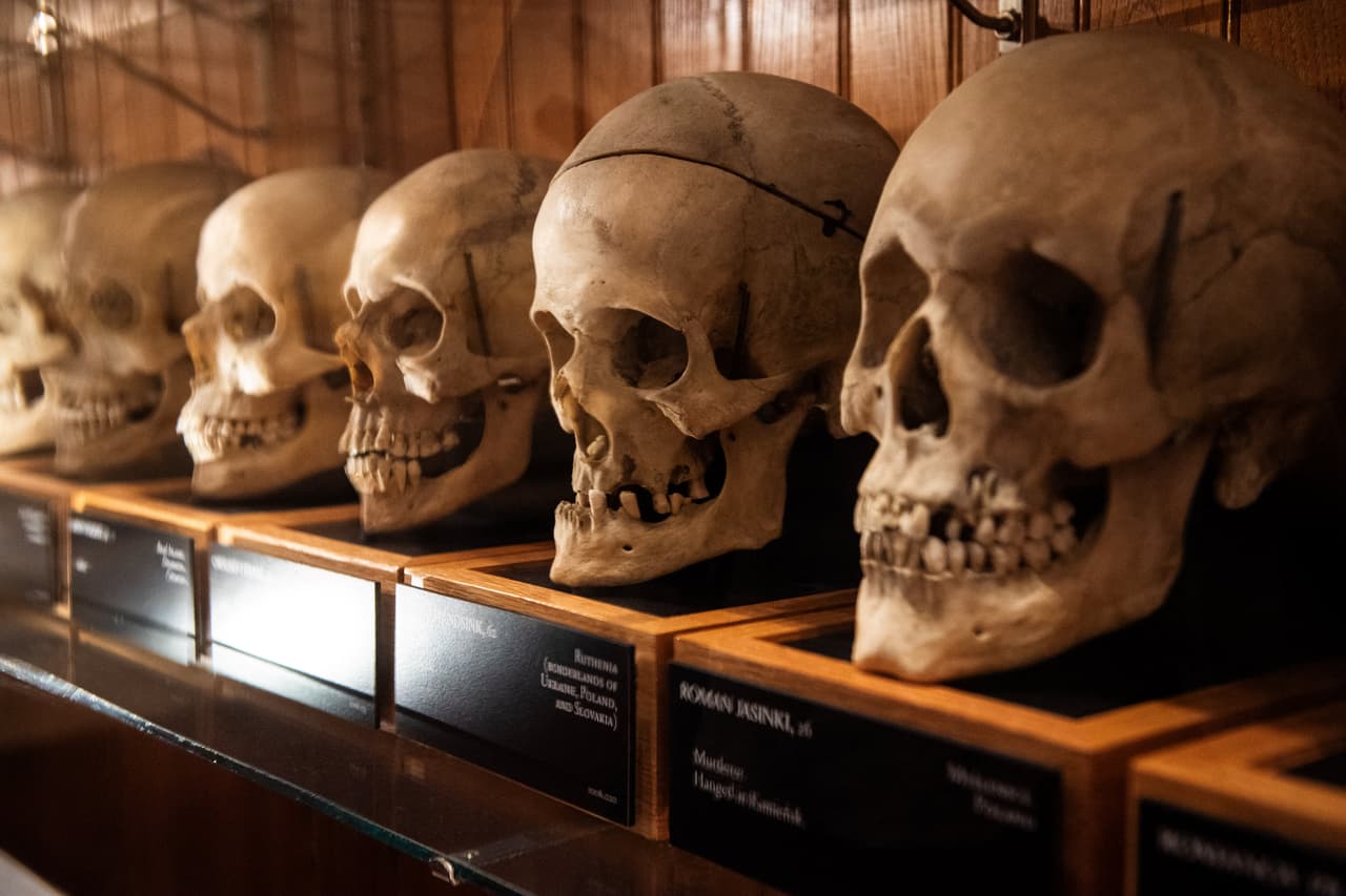 Cráneos de la Colección Josef Hyrtl en el Museo Mütter.