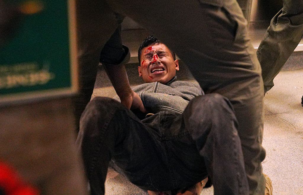 Mientras estuvo boca abajo, el
<b><a href="https://www.univision.com/local/north-carolina-wuvc/agentes-federales-detienen-a-trabajadores-de-la-construccion-durante-operativos-en-cary-video" target="_blank"> trabajador de la construcción,</a></b> que se comunicaba en español, sufrió heridas en la cara.