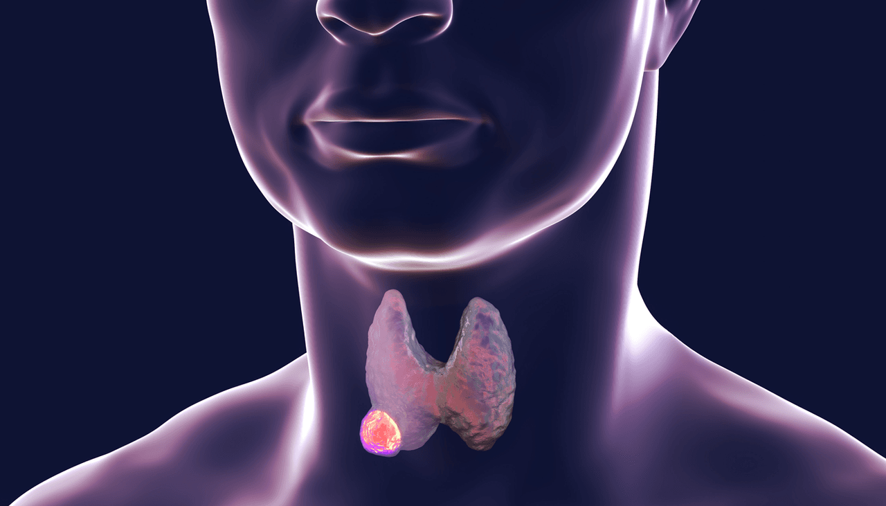 La enfermedad de la tiroides tiene dos síntomas comunes que casi nadie se imagina