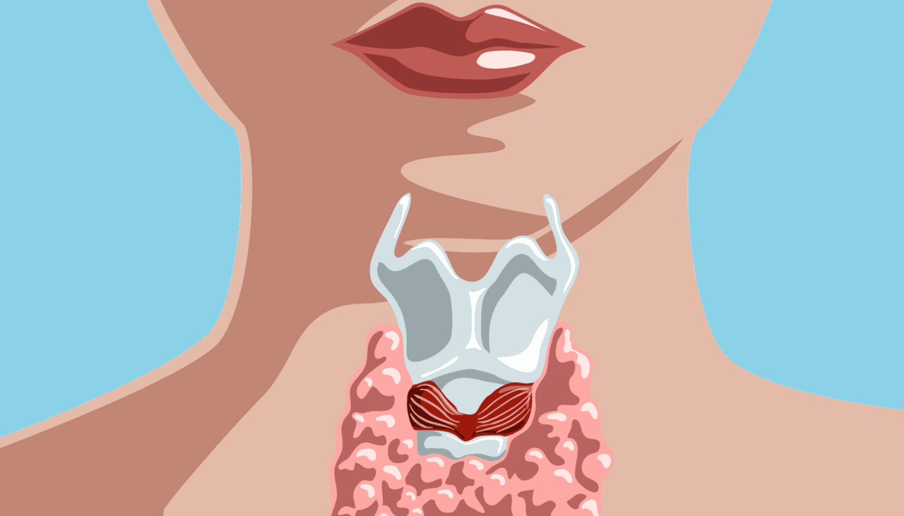 El hipotiroidismo da 22 señales, algunas muy comunes: cansancio, hinchazón, tristeza y más