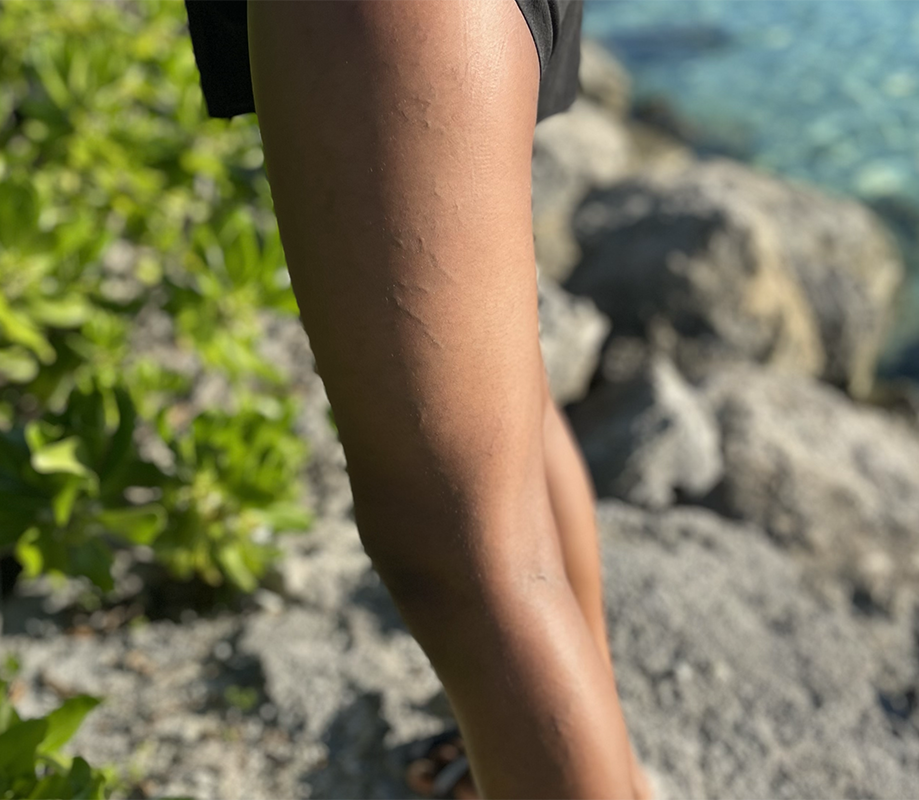 Piernas