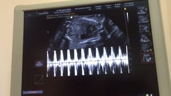 Julián no quiso perderse ningún momento del embarazo, por eso utilizaron la tecnología para que estuviera 'presente en el ultrasonido': "Así escucharon hoy mi corazón 😍 emocionado por ver a mi mamá, también estaba mi abuelita, mi papá que nos llamó por FaceTime y me vio también mi carita hermosa. No tenía muchas ganas de moverme, estoy un poco agotado de trabajar con mamá", publicó en Instagram.