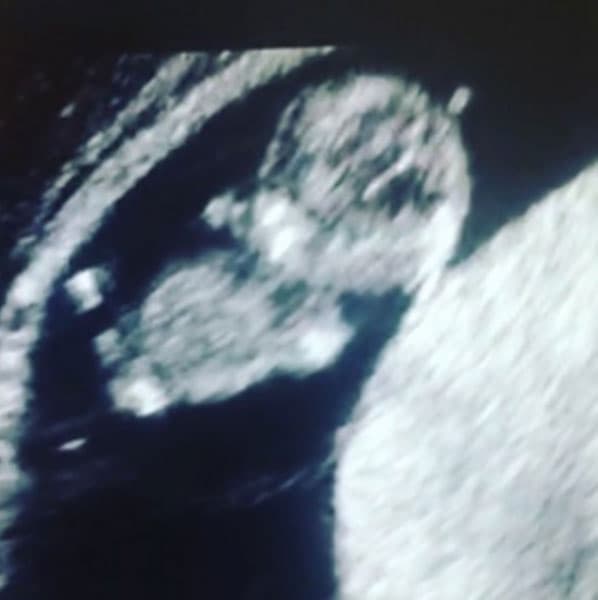 Desde que anunciaron el sexo del bebé crearon su cuenta en Instagram, donde los actores compartirán su crecimiento con sus seguidores.