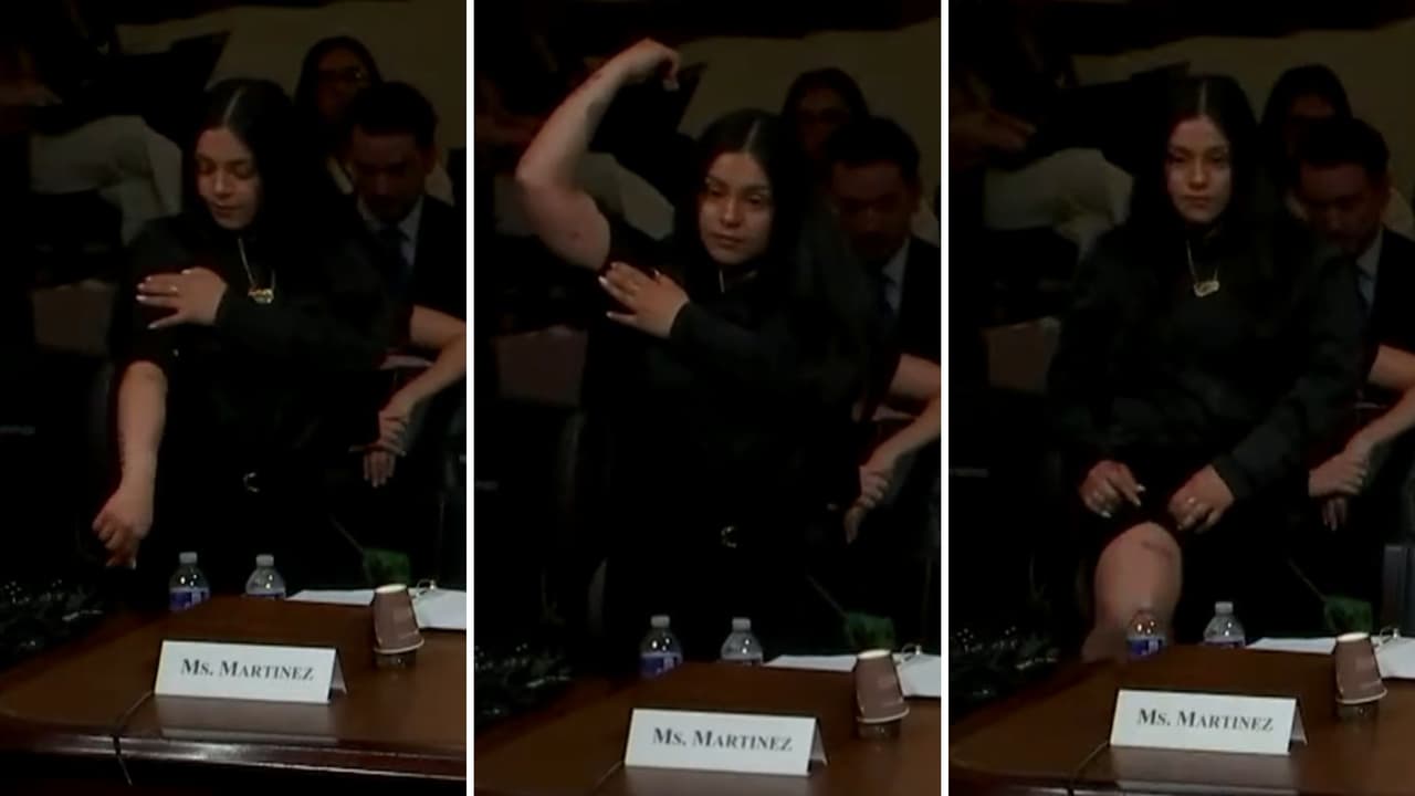 Marimar Martínez expone ante el Congreso las marcas que le dejó un agente fronterizo