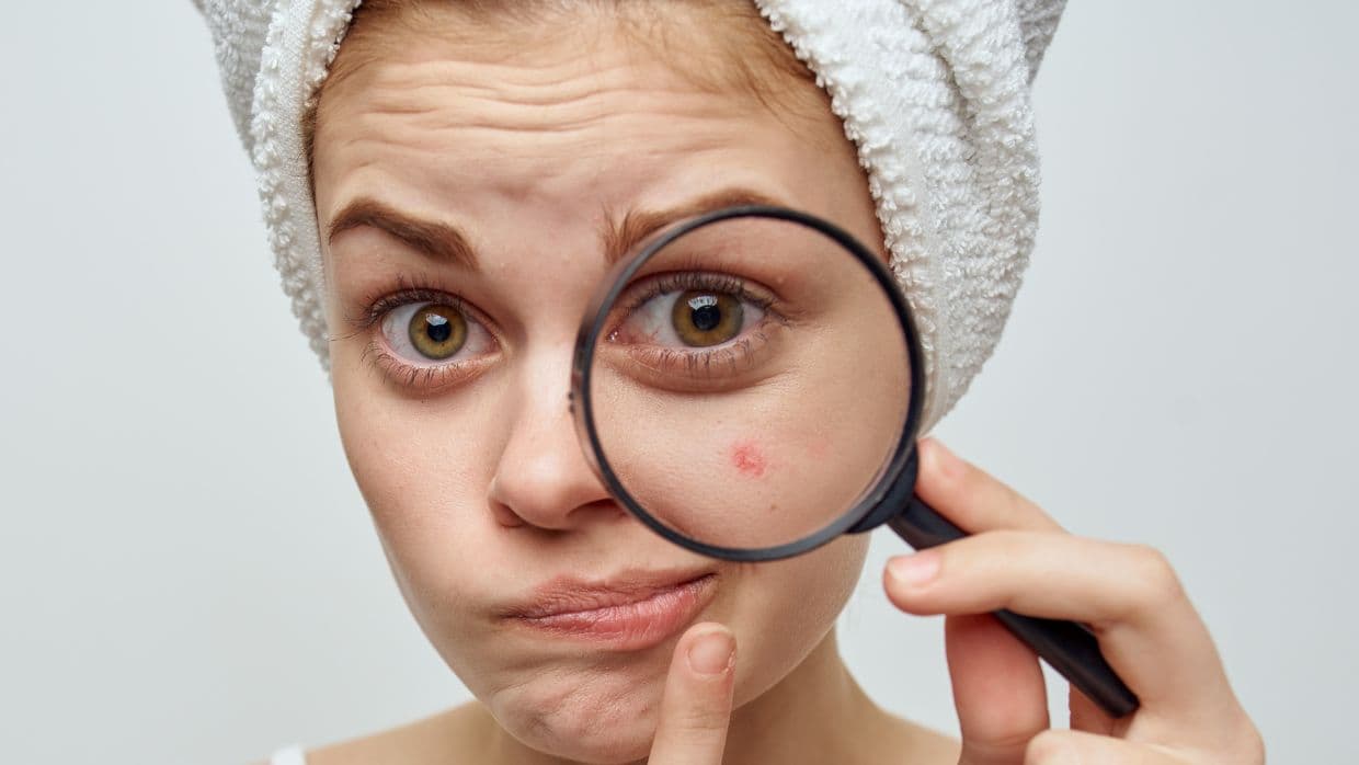 Descubre por qué te salen granitos en el rostro según su ubicación gracias al face mapping