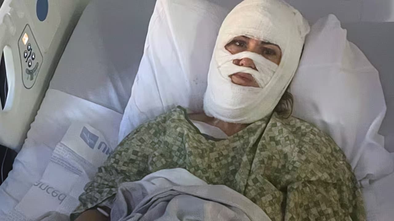 Mujer sufre quemaduras graves tras ataque con ácido en parque de Savannah