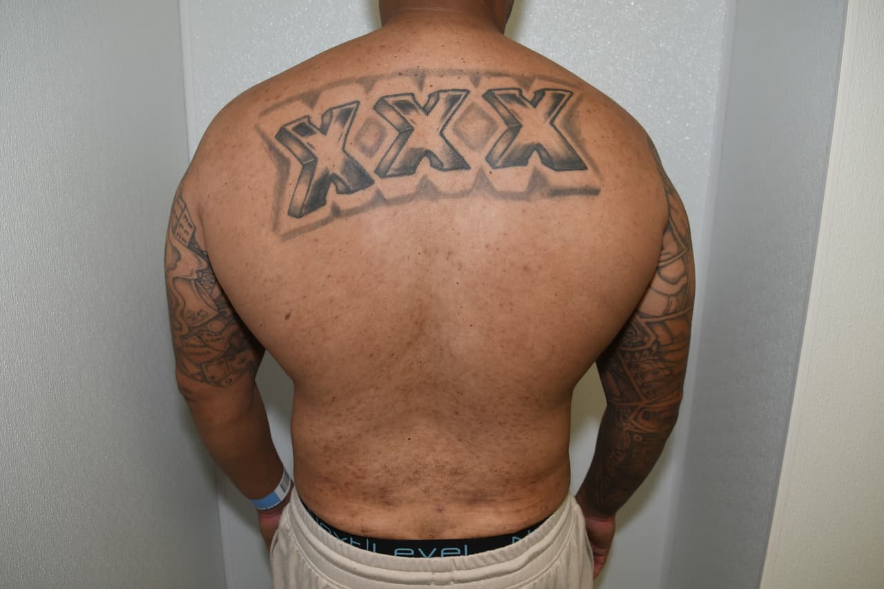 El Narra también tiene un tatuaje con
<b> tres x</b> en la espalda.
<br>