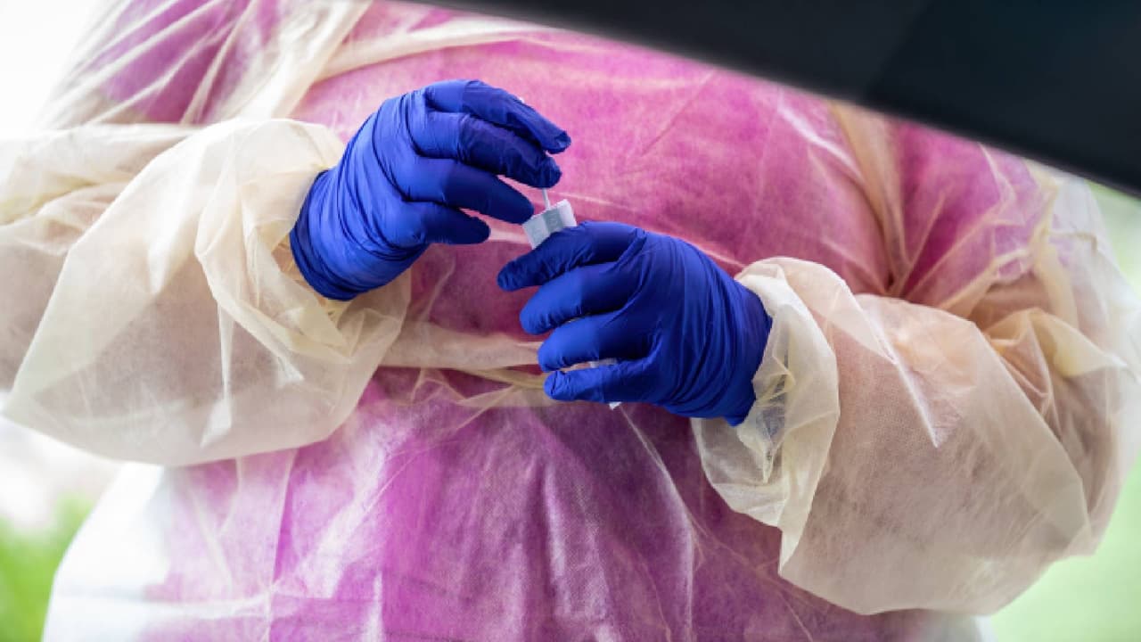 Arizona rompe récord con 24,964 casos de coronavirus en un solo día