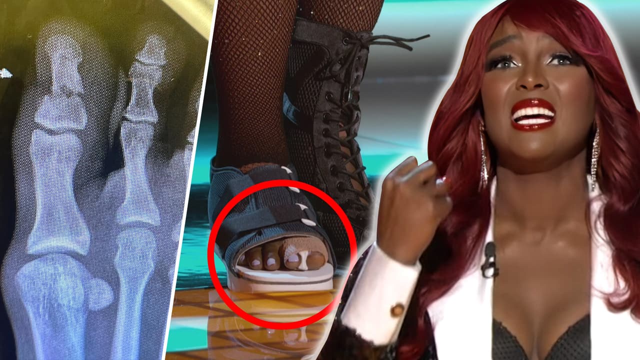 Mira Quién Baila ¡La Revancha!: Amara 'La Negra' se une a la lista de lesionados del reality show