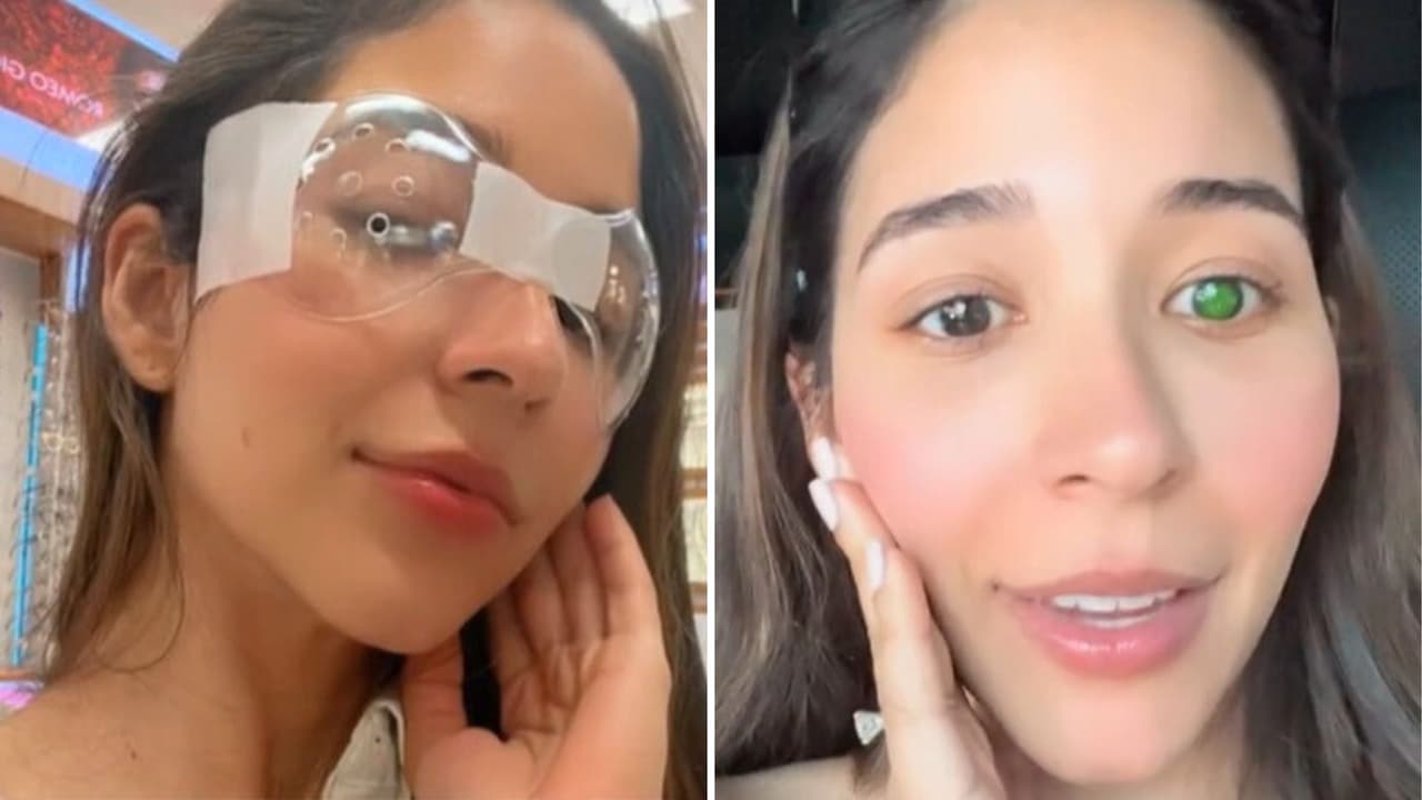 Joven se somete a cirugía ocular para mejorar su visión y termina con un ojo verde, ¿qué le pasó?