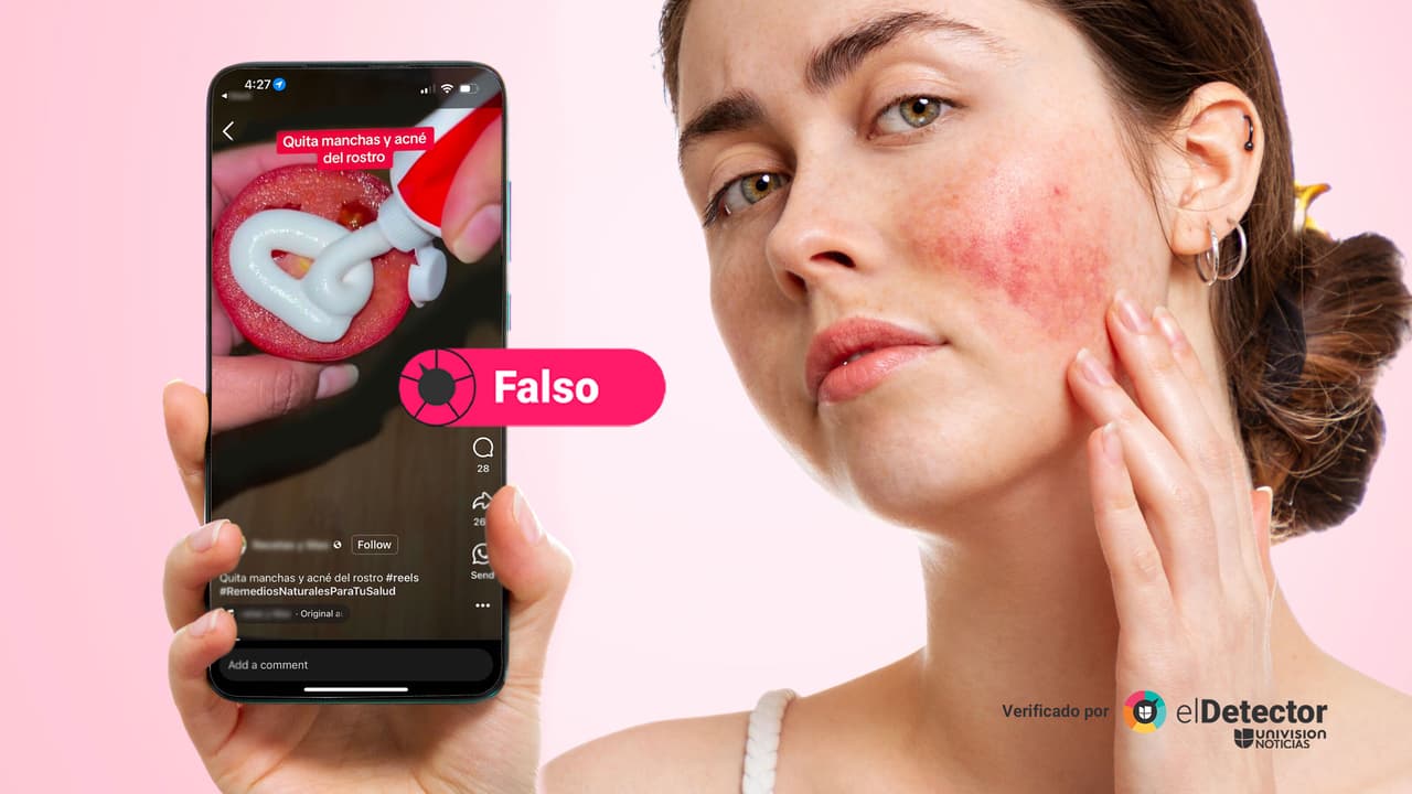 Una mezcla de tomate y pasta dental no te dejará libre de manchas y acné: dermatólogos advierten sobre sus riesgos