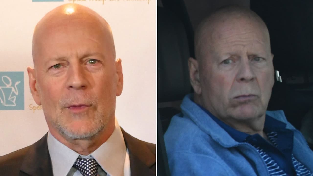 Bruce Willis sufre anosognosia: su esposa revela qué le ha provocado esta afección