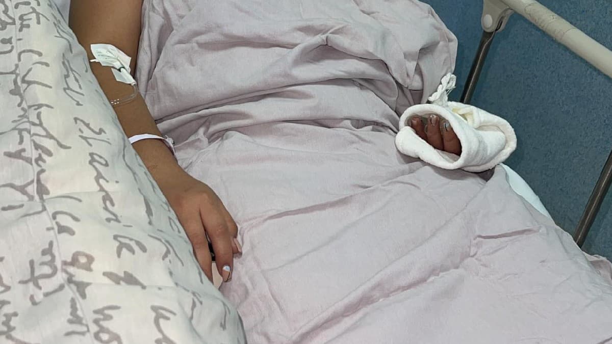 #JusticiaParaMarlene: joven fue atacada con ácido en Michoacán, su madre pide justicia