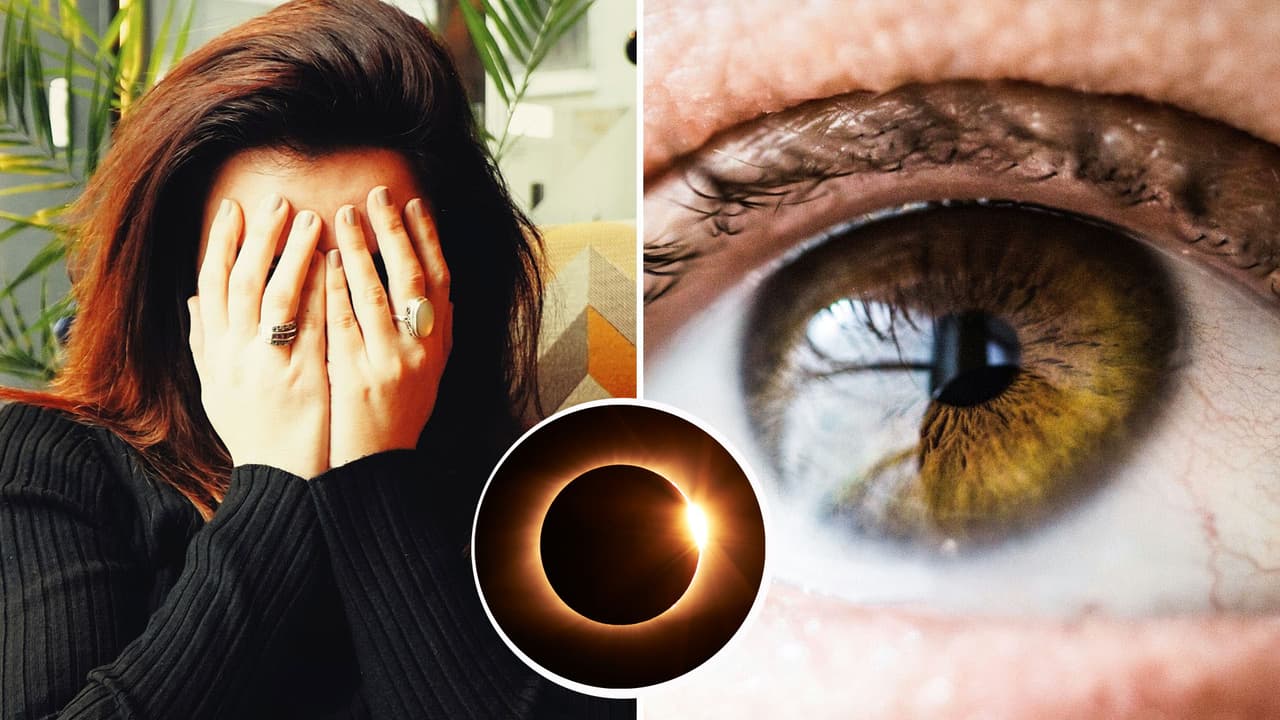 Vieron el eclipse sin protección y ahora tienen las pupilas 'deformes': ¿qué les pasó en los ojos?