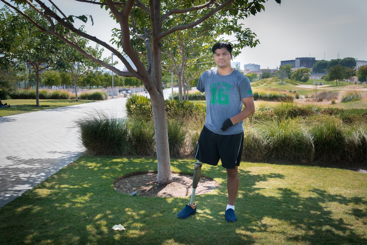 José Luis Hernández, oriundo de San José de los Guares, en Honduras, perdió dos extremidades y varios dedos luego de caer del tren en marcha conocido como “La Bestia”, que los migrantes usan para llegar a los Estados Unidos desde México. Hernández, hijo de recolectores de café, dijo que la desesperación fue la razón por la que estaba en ese tren, aquel día de 2008.