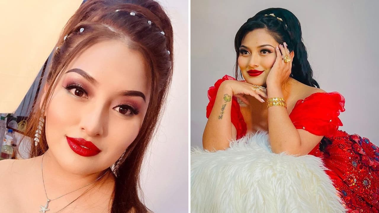 ¿Quién era ‘Muñequita Milly’, cantante que murió tras someterse a una liposucción?