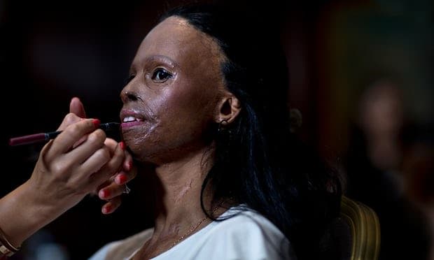 Ataques de ácido: ¿qué hay detrás de esta agresión cobarde y letal?