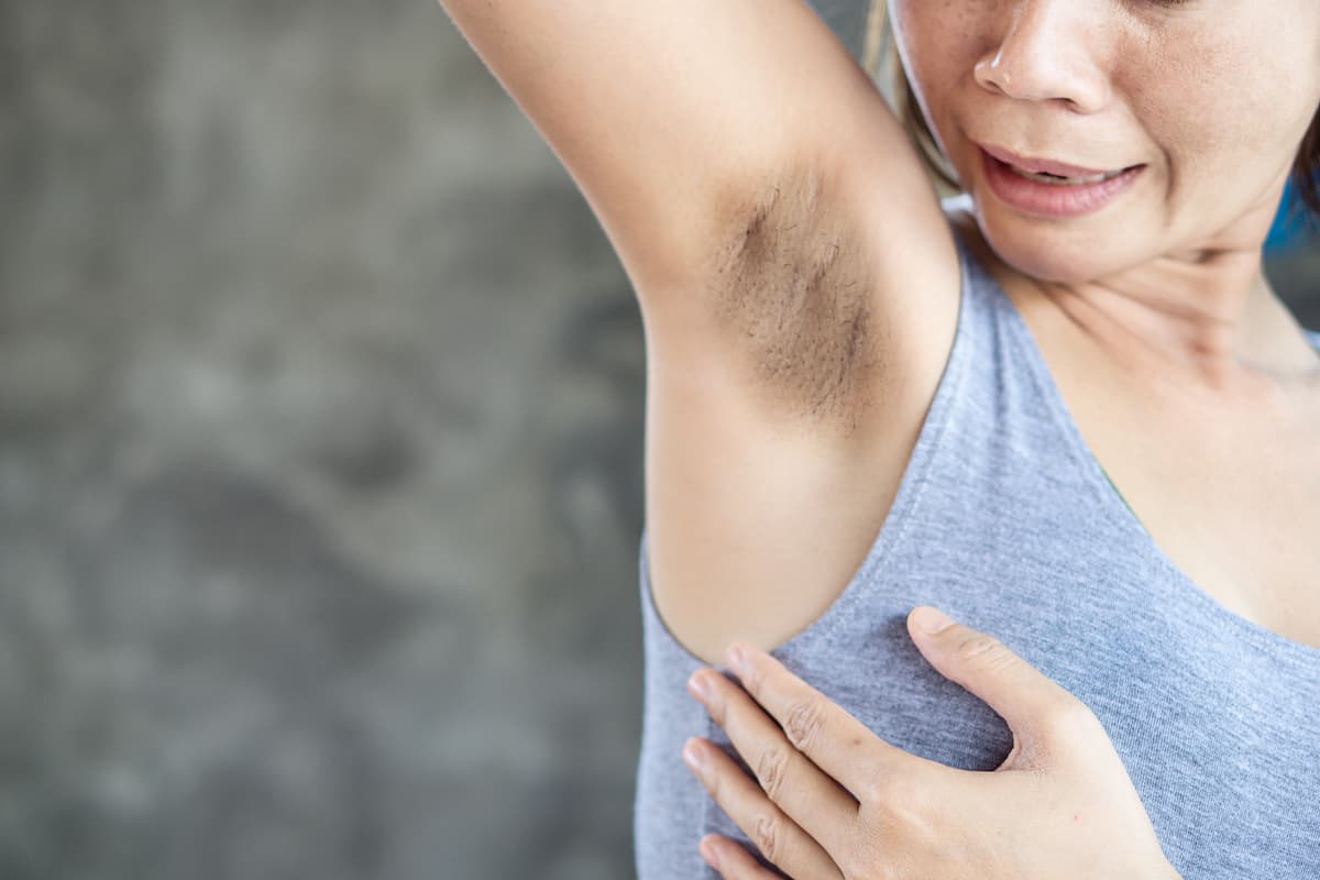 Mascarilla para aclarar las axilas: sólo necesitas un poco de betabel, papa y bicarbonato