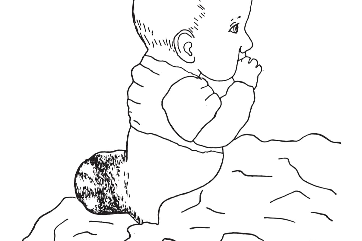 ¿Sabes qué es la espina bífida? Conoce sus causas y cómo prevenirla