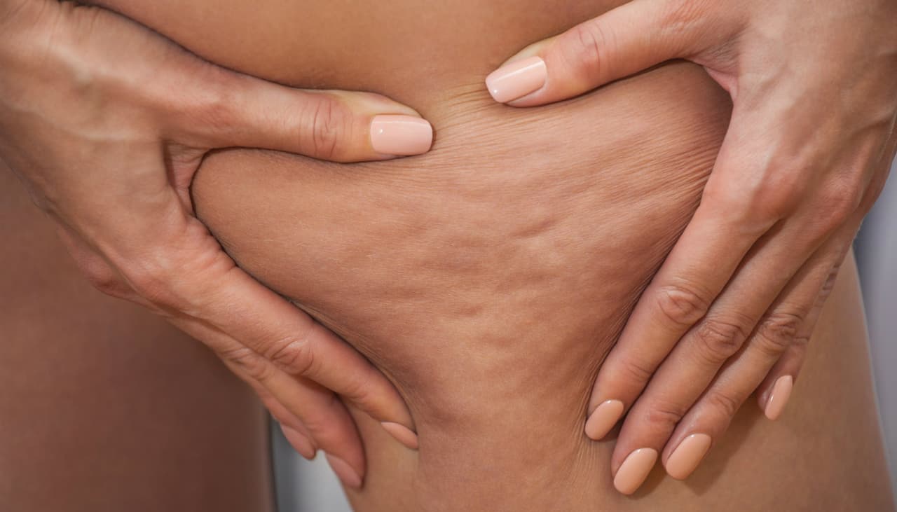 Piernas lisas y tonificadas:7 sencillas posturas de yoga para combatir la celulitis