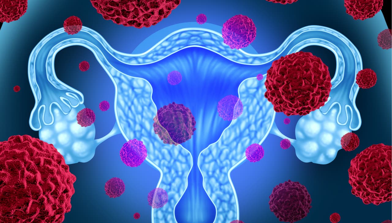 Adenomiosis, la enfermedad que se confunde con los "simples cólicos"