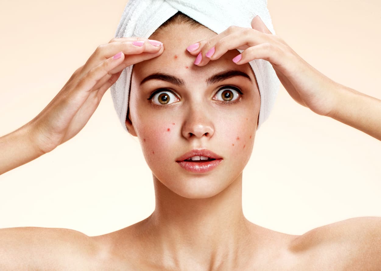 Tu celular podría ser el culpable de que te salgan granitos en la cara: hábitos para evitarlos
