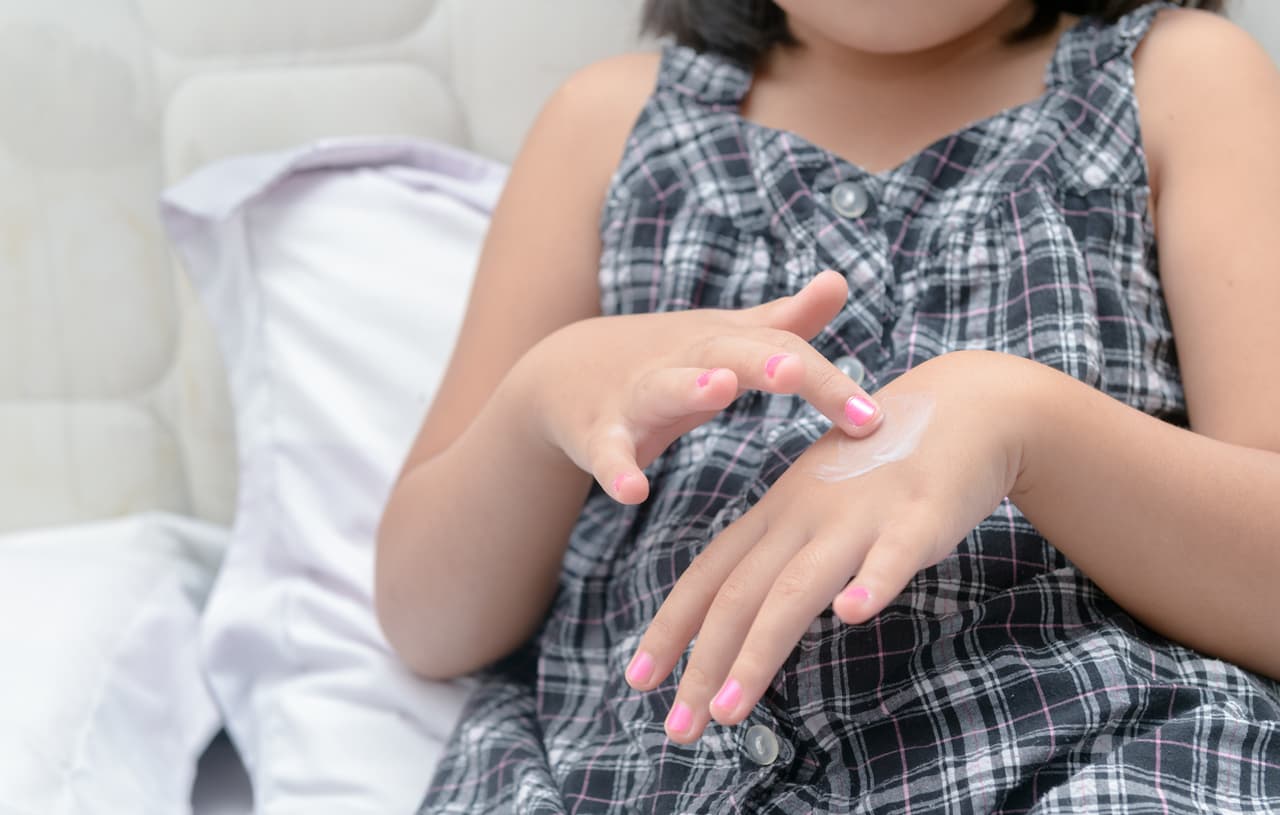 ¿Tu hijo sufre dermatitis atópica? Especialistas comparten consejos para tratar el problema