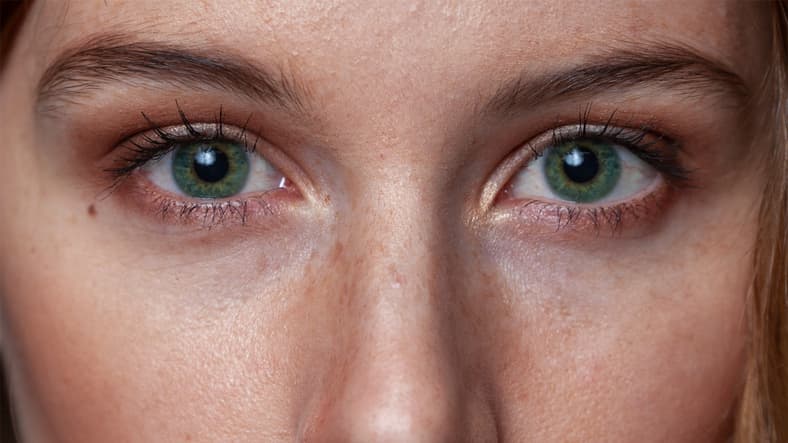 Las ojeras se pusieron de moda: ya no tendrás que cubrirlas ni esconderlas