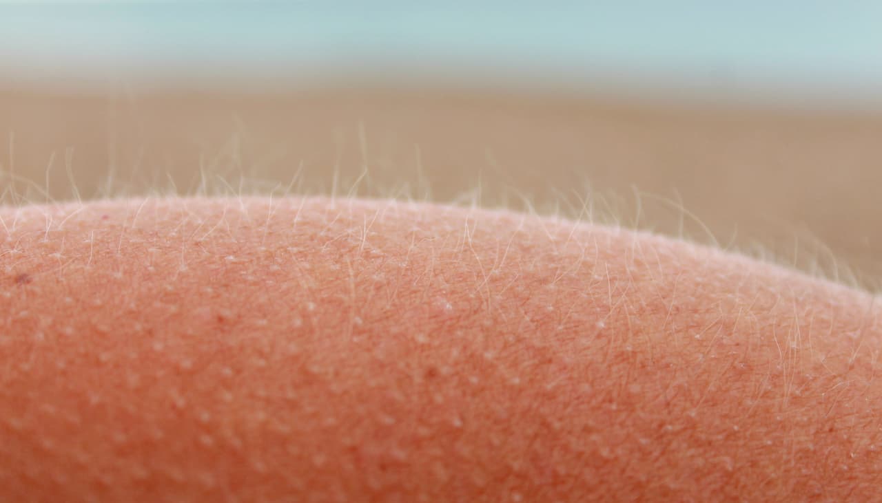 ¿Se te eriza la piel cuando escuchas música? Eso quiere decir que tu cerebro es especial