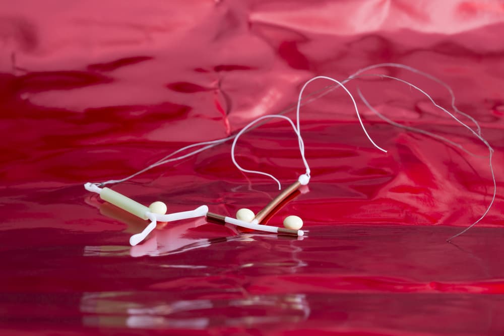 El SIU es tan efectivo como las pastillas anticonceptivas, pero no aumenta tu peso: conócelo