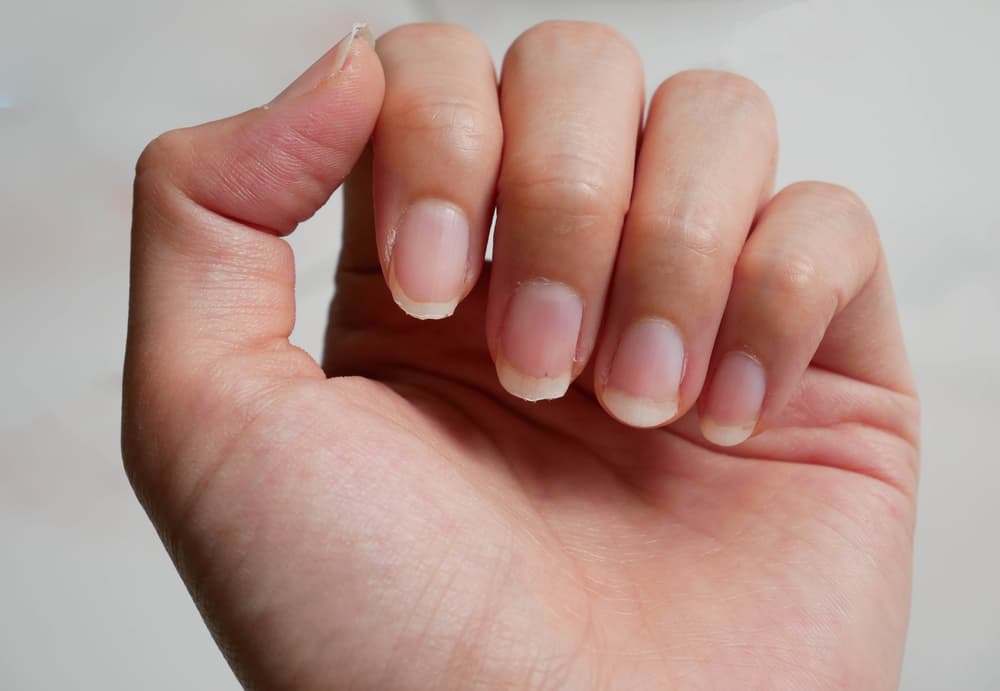 ¿Tus uñas se pusieron amarillentas por el esmalte? El vinagre eliminará las manchas