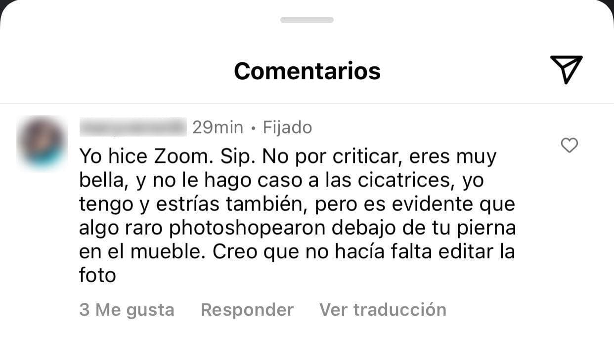 Sin embargo, hubo quien le dijo que era "evidente" que la imagen la
<b> "'photoshopearon' debajo de la pierna",</b> justo en la cicatriz: "No hacía falta editar la foto", le escribió una seguidora.
<br>
